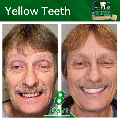 𝑂𝑓𝑓𝑖𝑐𝑖𝑎𝑙 𝑆𝑡𝑜𝑟𝑒👩‍⚕️🎁|𝐾𝑒𝑦𝑒𝑠𝑠® 𝑁𝑎𝑡𝑢𝑟𝑎𝑙 𝑇𝑟𝑒𝑒 𝑅𝑒𝑠𝑖𝑛 𝑅𝑒𝑚𝑖𝑛𝑒𝑟𝑎𝑙𝑖𝑧𝑖𝑛𝑔 𝐺𝑢𝑚🦷(Last 30 minutes of the limited-time offer!)