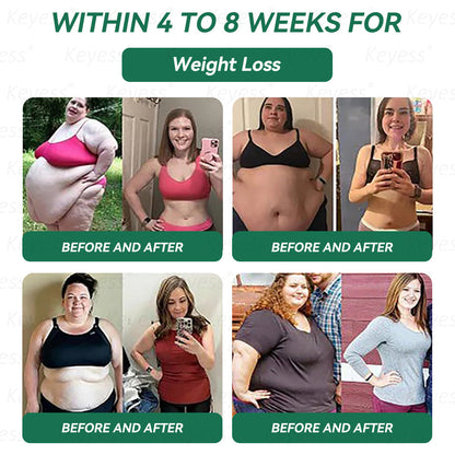 𝑶𝒇𝒇𝒊𝒄𝒊𝒂𝒍 𝑺𝒕𝒐𝒓𝒆 | 𝑲𝒆𝒚𝒆𝒔𝒔® 𝑮𝑳𝑷-1 𝑯𝒆𝒂𝒍𝒕𝒉 𝑺𝒐𝒍𝒖𝒕𝒊𝒐𝒏 𝑶𝒓𝒂𝒍 𝑳𝒊𝒒𝒖𝒊𝒅 - 𝑭𝒆𝒎𝒊𝒏𝒊𝒏𝒆 𝑫𝒆𝒕𝒐𝒙 𝑭𝒐𝒓𝒎𝒖𝒍𝒂