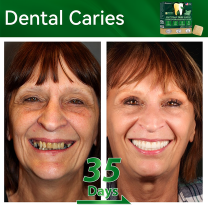 𝑂𝑓𝑓𝑖𝑐𝑖𝑎𝑙 𝑆𝑡𝑜𝑟𝑒👩‍⚕️🎁|𝐾𝑒𝑦𝑒𝑠𝑠® 𝑁𝑎𝑡𝑢𝑟𝑎𝑙 𝑇𝑟𝑒𝑒 𝑅𝑒𝑠𝑖𝑛 𝑅𝑒𝑚𝑖𝑛𝑒𝑟𝑎𝑙𝑖𝑧𝑖𝑛𝑔 𝐺𝑢𝑚🦷(Last 30 minutes of the limited-time offer!)