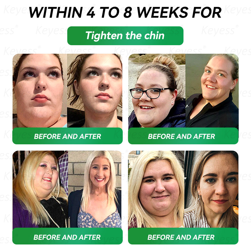 𝖮𝖿𝖿𝗂𝖼𝗂𝖺𝗅 𝖲𝗍𝗈𝗋𝖾 |👩‍⚕️🎉 𝐊𝒆𝒚𝒆ss® 𝑮𝑳𝑷-1 9-𝒊𝒏-1 𝑯𝒆𝒂𝒍𝒕𝒉 𝑶𝒓𝒂𝒍 𝑳𝒊𝒒𝒖𝒊𝒅 (𝐎𝐧𝐥𝐲 𝐨𝐧𝐜𝐞 𝐚 𝐝𝐚𝐲, 𝐰𝐢𝐭𝐡 𝐯𝐢𝐬𝐢𝐛𝐥𝐞 𝐫𝐞𝐬𝐮𝐥𝐭𝐬 𝐢𝐧 𝐣𝐮𝐬𝐭 𝟕 𝐝𝐚𝐲𝐬 — 𝐡𝐞𝐥𝐩𝐬 𝐰𝐢𝐭𝐡 𝐨𝐛𝐞𝐬𝐢𝐭𝐲, 𝐥𝐨𝐨𝐬𝐞 𝐬𝐤𝐢𝐧, 𝐡𝐞𝐚𝐫𝐭 𝐡𝐞𝐚𝐥𝐭𝐡, 𝐝𝐢𝐚𝐛𝐞𝐭𝐞𝐬, 𝐠𝐮𝐭 𝐛𝐚𝐥𝐚𝐧𝐜𝐞, 𝐚𝐧𝐝 𝐣𝐨𝐢𝐧𝐭 𝐢𝐧𝐟𝐥𝐚𝐦𝐦𝐚𝐭𝐢𝐨𝐧)