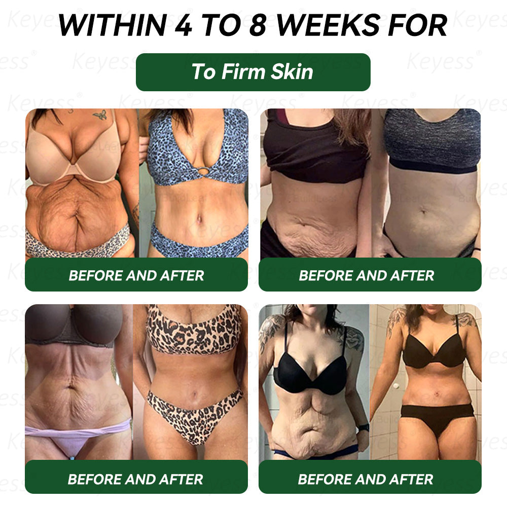 𝐎𝐟𝐟𝐢𝐜𝐢𝐚𝐥 𝐒𝐭𝐨𝐫𝐞 | 𝑲𝒆𝒚𝒆𝒔𝒔® 👩‍⚕️𝑮𝑳𝑷-1 9-𝒊𝒏-1 𝑯𝒆𝒂𝒍𝒕𝒉 𝑶𝒓𝒂𝒍 𝑳𝒊𝒒𝒖𝒊𝒅 — 𝑰𝒎𝒎𝒖𝒏𝒆 & 𝑫𝒆𝒕𝒐𝒙 𝑺𝒖𝒑𝒑𝒐𝒓𝒕 𝑭𝒐𝒓𝒎𝒖𝒍𝒂