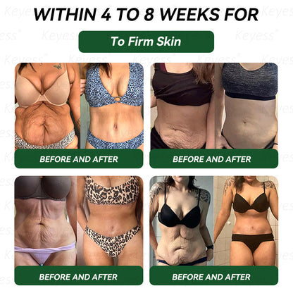 𝐎𝐟𝐟𝐢𝐜𝐢𝐚𝐥 𝐒𝐭𝐨𝐫𝐞 | 𝑲𝒆𝒚𝒆𝒔𝒔® 👩‍⚕️𝑮𝑳𝑷-1 9-𝒊𝒏-1 𝑯𝒆𝒂𝒍𝒕𝒉 𝑶𝒓𝒂𝒍 𝑳𝒊𝒒𝒖𝒊𝒅 — 𝑰𝒎𝒎𝒖𝒏𝒆 & 𝑫𝒆𝒕𝒐𝒙 𝑺𝒖𝒑𝒑𝒐𝒓𝒕 𝑭𝒐𝒓𝒎𝒖𝒍𝒂