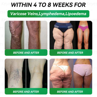 𝐎𝐟𝐟𝐢𝐜𝐢𝐚𝐥 𝐒𝐭𝐨𝐫𝐞 | 𝑲𝒆𝒚𝒆𝒔𝒔® 👩‍⚕️𝑮𝑳𝑷-1 9-𝒊𝒏-1 𝑯𝒆𝒂𝒍𝒕𝒉 𝑶𝒓𝒂𝒍 𝑳𝒊𝒒𝒖𝒊𝒅 — 𝑰𝒎𝒎𝒖𝒏𝒆 & 𝑫𝒆𝒕𝒐𝒙 𝑺𝒖𝒑𝒑𝒐𝒓𝒕 𝑭𝒐𝒓𝒎𝒖𝒍𝒂