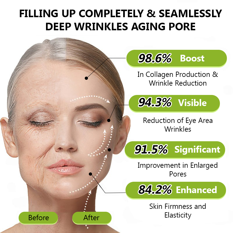 𝑶𝒇𝒇𝒊𝒄𝒊𝒂𝒍 𝑺𝒕𝒐𝒓𝒆🗽 |Regain youthful skin nown 💫STDEI® BOTOX & VITA A RETINOL SHOT Wrinkle Lift Tightening Cream