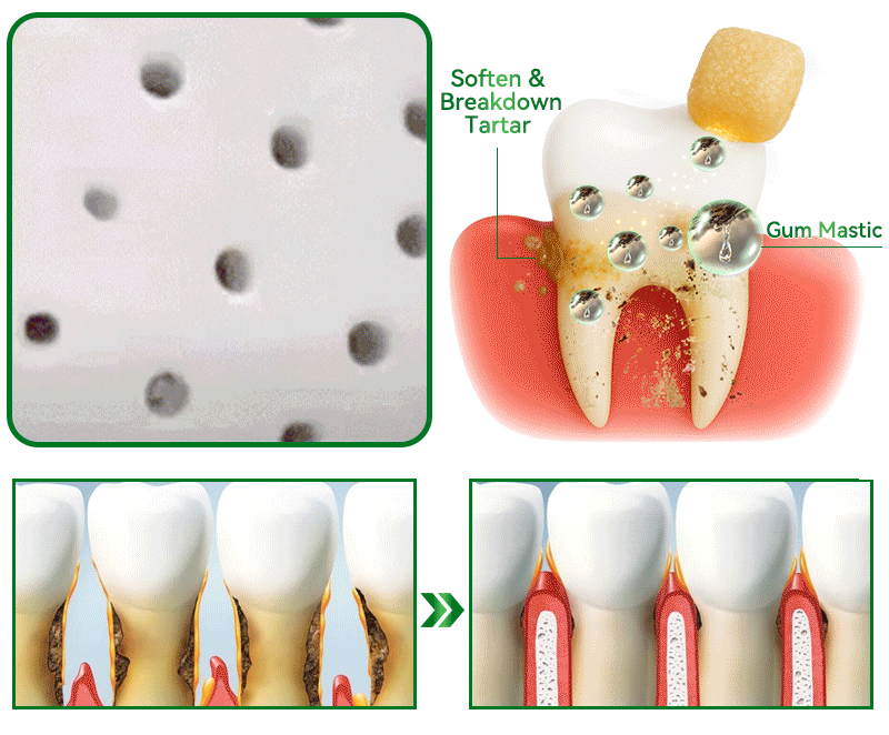 𝑂𝑓𝑓𝑖𝑐𝑖𝑎𝑙 𝑆𝑡𝑜𝑟𝑒👩‍⚕️🎁|𝐾𝑒𝑦𝑒𝑠𝑠® 𝑁𝑎𝑡𝑢𝑟𝑎𝑙 𝑇𝑟𝑒𝑒 𝑅𝑒𝑠𝑖𝑛 𝑅𝑒𝑚𝑖𝑛𝑒𝑟𝑎𝑙𝑖𝑧𝑖𝑛𝑔 𝐺𝑢𝑚🦷(Last 30 minutes of the limited-time offer!)