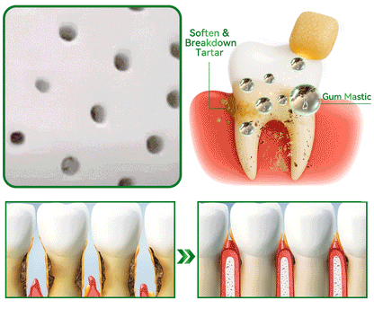 𝑂𝑓𝑓𝑖𝑐𝑖𝑎𝑙 𝑆𝑡𝑜𝑟𝑒👩‍⚕️🎁|𝐾𝑒𝑦𝑒𝑠𝑠® 𝑁𝑎𝑡𝑢𝑟𝑎𝑙 𝑇𝑟𝑒𝑒 𝑅𝑒𝑠𝑖𝑛 𝑅𝑒𝑚𝑖𝑛𝑒𝑟𝑎𝑙𝑖𝑧𝑖𝑛𝑔 𝐺𝑢𝑚🦷(Last 30 minutes of the limited-time offer!)