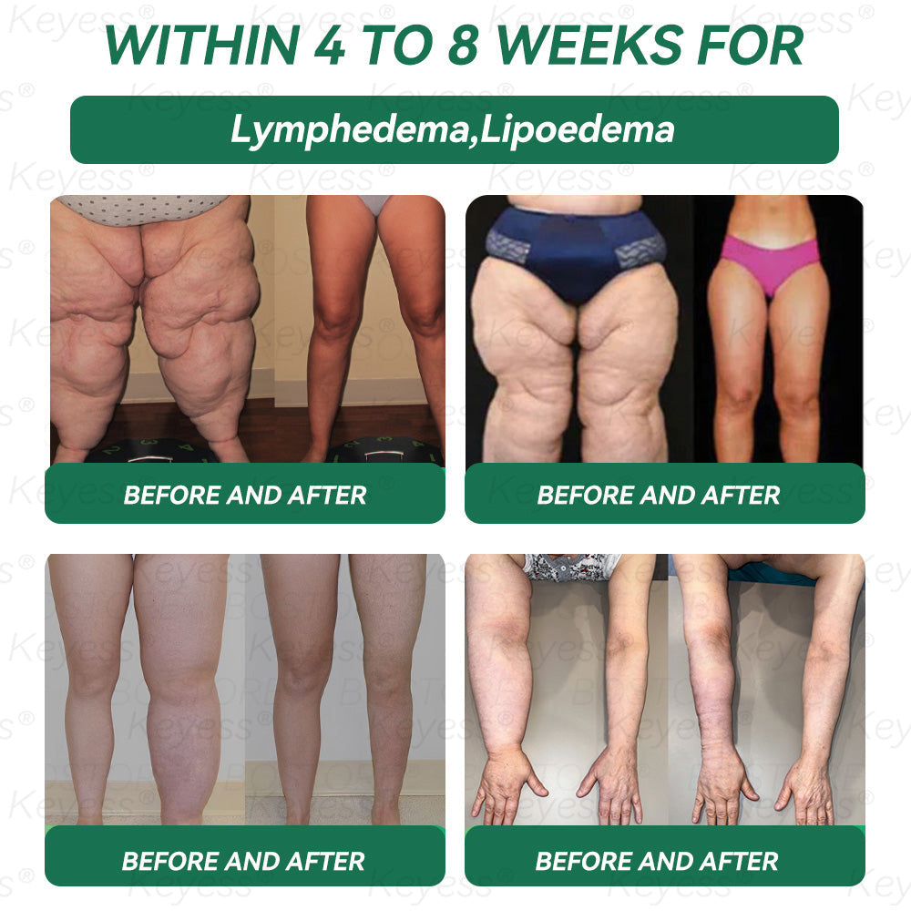 𝑶𝒇𝒇𝒊𝒄𝒊𝒂𝒍 𝑺𝒕𝒐𝒓𝒆 | 𝑲𝒆𝒚𝒆𝒔𝒔® 𝑮𝑳𝑷-1 𝑯𝒆𝒂𝒍𝒕𝒉 𝑺𝒐𝒍𝒖𝒕𝒊𝒐𝒏 𝑶𝒓𝒂𝒍 𝑳𝒊𝒒𝒖𝒊𝒅 - 𝑭𝒆𝒎𝒊𝒏𝒊𝒏𝒆 𝑫𝒆𝒕𝒐𝒙 𝑭𝒐𝒓𝒎𝒖𝒍𝒂