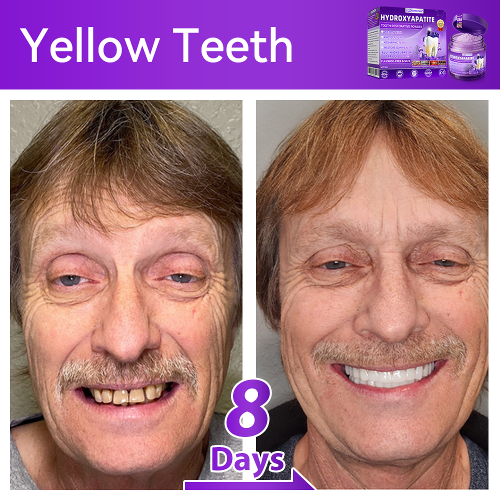 𝑂𝑓𝑓𝑖𝑐𝑖𝑎𝑙 𝑆𝑡𝑜𝑟𝑒🍀|𝐷𝑜𝑟𝑚𝑜𝑟𝑛𝑎® 𝐻𝑦𝑑𝑟𝑜𝑥𝑦𝑎𝑝𝑎𝑡𝑖𝑡𝑒 𝑇𝑜𝑜𝑡ℎ 𝑅𝑒𝑠𝑡𝑜𝑟𝑎𝑡𝑖𝑣𝑒 𝑃𝑜𝑤𝑑𝑒𝑟🦷(Last 30 minutes of the limited-time offer!)