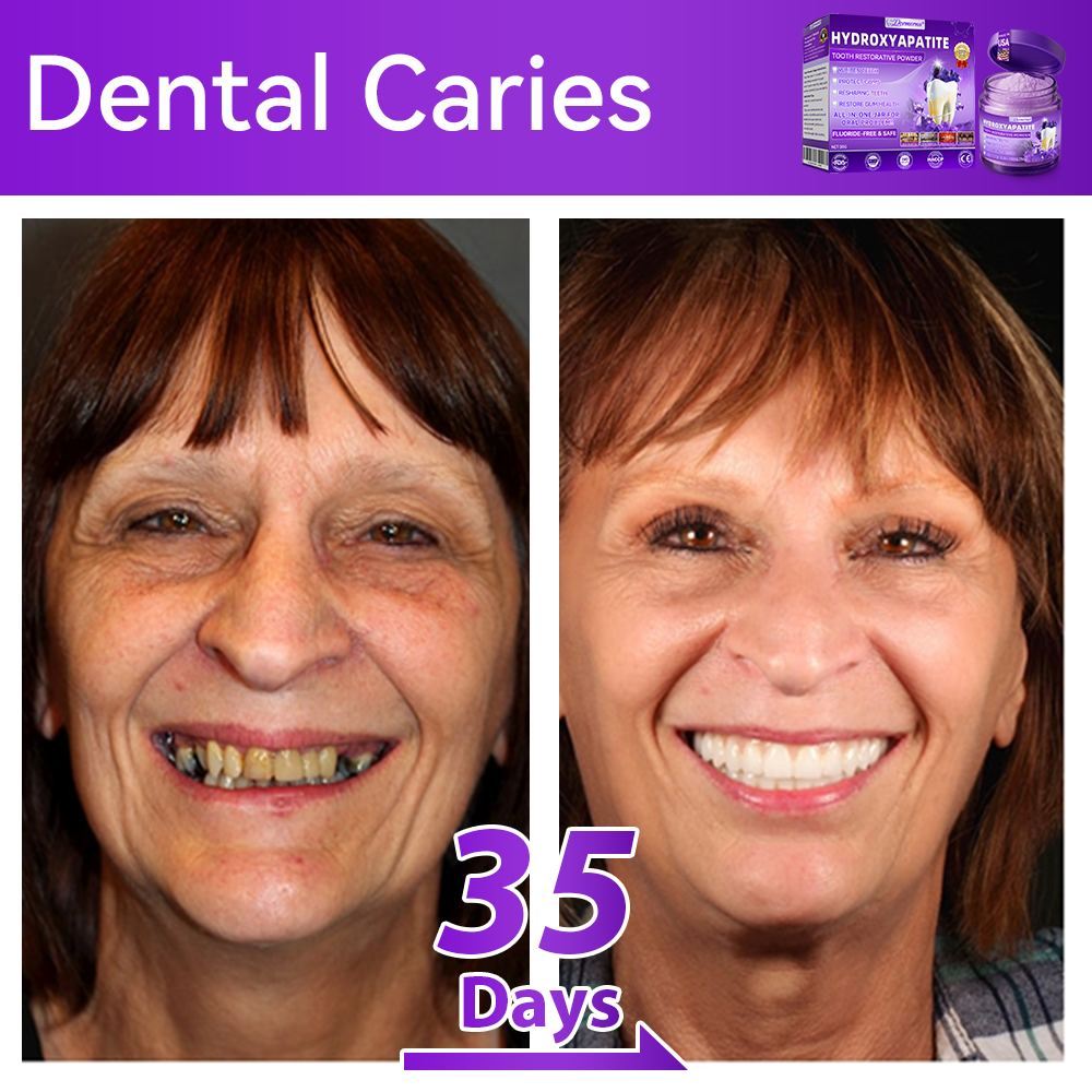 𝑂𝑓𝑓𝑖𝑐𝑖𝑎𝑙 𝑆𝑡𝑜𝑟𝑒🍀|𝐷𝑜𝑟𝑚𝑜𝑟𝑛𝑎® 𝐻𝑦𝑑𝑟𝑜𝑥𝑦𝑎𝑝𝑎𝑡𝑖𝑡𝑒 𝑇𝑜𝑜𝑡ℎ 𝑅𝑒𝑠𝑡𝑜𝑟𝑎𝑡𝑖𝑣𝑒 𝑃𝑜𝑤𝑑𝑒𝑟🦷(Last 30 minutes of the limited-time offer!)