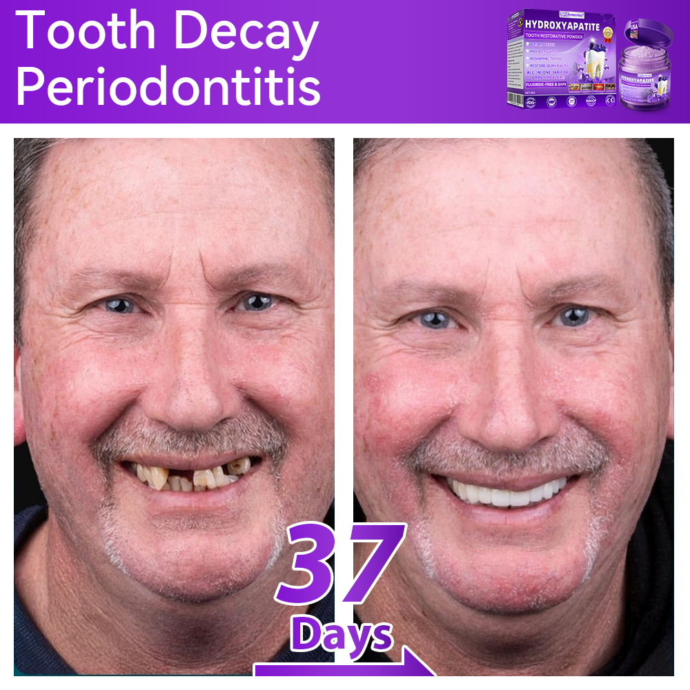 𝑂𝑓𝑓𝑖𝑐𝑖𝑎𝑙 𝑆𝑡𝑜𝑟𝑒🍀|𝐷𝑜𝑟𝑚𝑜𝑟𝑛𝑎® 𝐻𝑦𝑑𝑟𝑜𝑥𝑦𝑎𝑝𝑎𝑡𝑖𝑡𝑒 𝑇𝑜𝑜𝑡ℎ 𝑅𝑒𝑠𝑡𝑜𝑟𝑎𝑡𝑖𝑣𝑒 𝑃𝑜𝑤𝑑𝑒𝑟🦷(Last 30 minutes of the limited-time offer!)