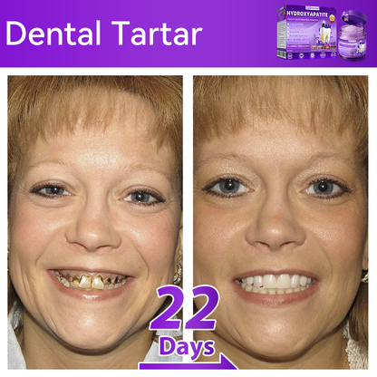 𝑂𝑓𝑓𝑖𝑐𝑖𝑎𝑙 𝑆𝑡𝑜𝑟𝑒🍀|𝐷𝑜𝑟𝑚𝑜𝑟𝑛𝑎® 𝐻𝑦𝑑𝑟𝑜𝑥𝑦𝑎𝑝𝑎𝑡𝑖𝑡𝑒 𝑇𝑜𝑜𝑡ℎ 𝑅𝑒𝑠𝑡𝑜𝑟𝑎𝑡𝑖𝑣𝑒 𝑃𝑜𝑤𝑑𝑒𝑟🦷(Last 30 minutes of the limited-time offer!)