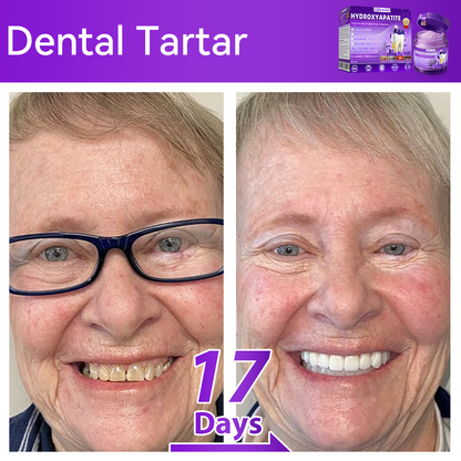 𝑂𝑓𝑓𝑖𝑐𝑖𝑎𝑙 𝑆𝑡𝑜𝑟𝑒🍀|𝐷𝑜𝑟𝑚𝑜𝑟𝑛𝑎® 𝐻𝑦𝑑𝑟𝑜𝑥𝑦𝑎𝑝𝑎𝑡𝑖𝑡𝑒 𝑇𝑜𝑜𝑡ℎ 𝑅𝑒𝑠𝑡𝑜𝑟𝑎𝑡𝑖𝑣𝑒 𝑃𝑜𝑤𝑑𝑒𝑟🦷(Last 30 minutes of the limited-time offer!)