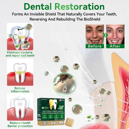 𝑂𝑓𝑓𝑖𝑐𝑖𝑎𝑙 𝑆𝑡𝑜𝑟𝑒👩‍⚕️🎁|𝐾𝑒𝑦𝑒𝑠𝑠® 𝑁𝑎𝑡𝑢𝑟𝑎𝑙 𝑇𝑟𝑒𝑒 𝑅𝑒𝑠𝑖𝑛 𝑅𝑒𝑚𝑖𝑛𝑒𝑟𝑎𝑙𝑖𝑧𝑖𝑛𝑔 𝐺𝑢𝑚🦷(Last 30 minutes of the limited-time offer!)