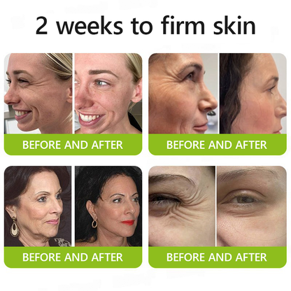 𝑶𝒇𝒇𝒊𝒄𝒊𝒂𝒍 𝑺𝒕𝒐𝒓𝒆🗽 |Regain youthful skin nown 💫STDEI® BOTOX & VITA A RETINOL SHOT Wrinkle Lift Tightening Cream