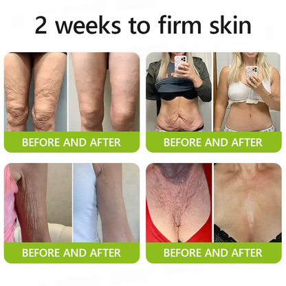 𝑶𝒇𝒇𝒊𝒄𝒊𝒂𝒍 𝑺𝒕𝒐𝒓𝒆🗽 |Regain youthful skin nown 💫STDEI® BOTOX & VITA A RETINOL SHOT Wrinkle Lift Tightening Cream