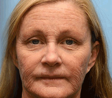 𝑶𝒇𝒇𝒊𝒄𝒊𝒂𝒍 𝑺𝒕𝒐𝒓𝒆🗽 |Regain youthful skin nown 💫STDEI® BOTOX & VITA A RETINOL SHOT Wrinkle Lift Tightening Cream