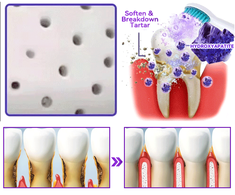 𝑂𝑓𝑓𝑖𝑐𝑖𝑎𝑙 𝑆𝑡𝑜𝑟𝑒🍀|𝐷𝑜𝑟𝑚𝑜𝑟𝑛𝑎® 𝐻𝑦𝑑𝑟𝑜𝑥𝑦𝑎𝑝𝑎𝑡𝑖𝑡𝑒 𝑇𝑜𝑜𝑡ℎ 𝑅𝑒𝑠𝑡𝑜𝑟𝑎𝑡𝑖𝑣𝑒 𝑃𝑜𝑤𝑑𝑒𝑟🦷(Last 30 minutes of the limited-time offer!)