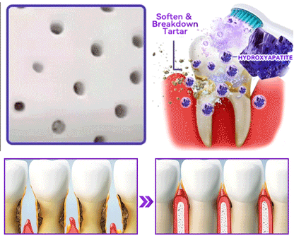 𝑂𝑓𝑓𝑖𝑐𝑖𝑎𝑙 𝑆𝑡𝑜𝑟𝑒🍀|𝐷𝑜𝑟𝑚𝑜𝑟𝑛𝑎® 𝐻𝑦𝑑𝑟𝑜𝑥𝑦𝑎𝑝𝑎𝑡𝑖𝑡𝑒 𝑇𝑜𝑜𝑡ℎ 𝑅𝑒𝑠𝑡𝑜𝑟𝑎𝑡𝑖𝑣𝑒 𝑃𝑜𝑤𝑑𝑒𝑟🦷(Last 30 minutes of the limited-time offer!)